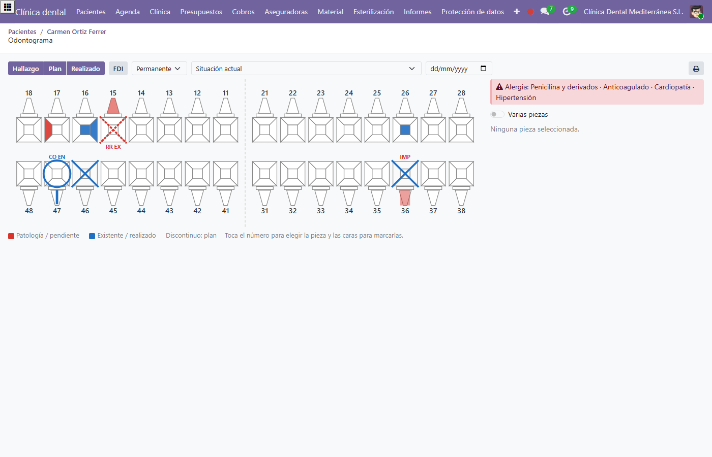 Odontograma interactivo en Odoo con arcada superior e inferior, hallazgos por cara dental y alertas médicas